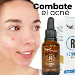 Serum Retinol Afrodita 0.5% combate acné y mejora piel, ideal para rostro.