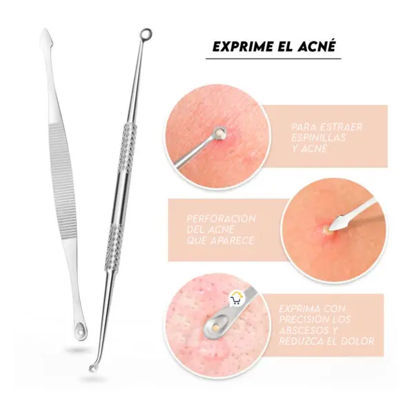 Kit extractor de acné: 7 piezas para eliminar espinillas y puntos negros con precisión.