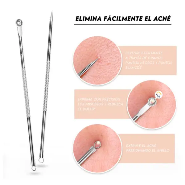 Kit extractor de acné: remueve espinillas, puntos negros y blancos con precisión.