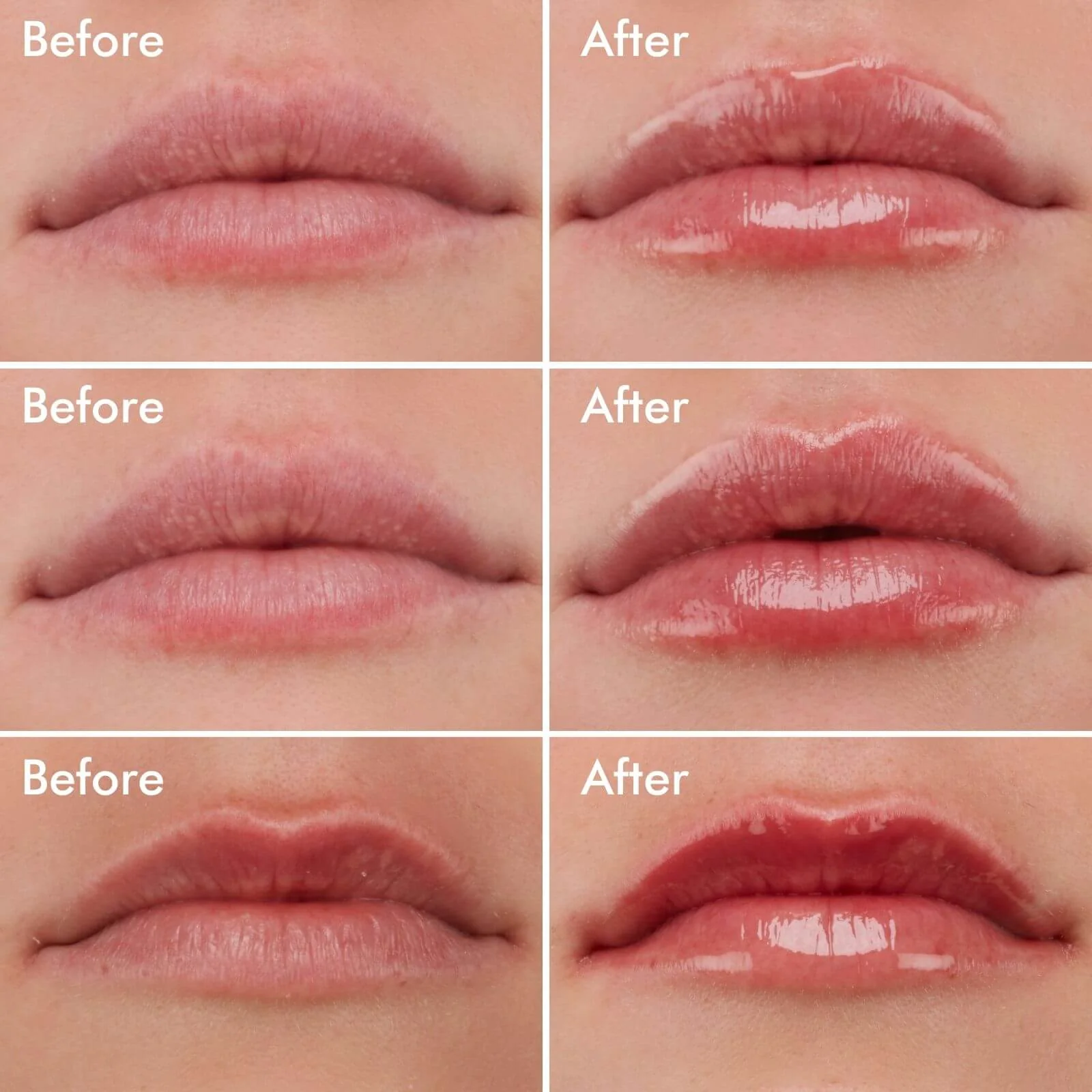 Set x2 Voluminizador Extreme XXL Lip Plumper: antes y después de labios con brillo y volumen.