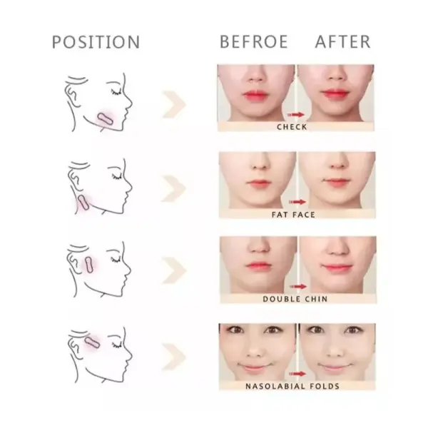 Cinta Facial Secret Lift: antes y después para definir contorno, reducir grasa y eliminar doble mentón.