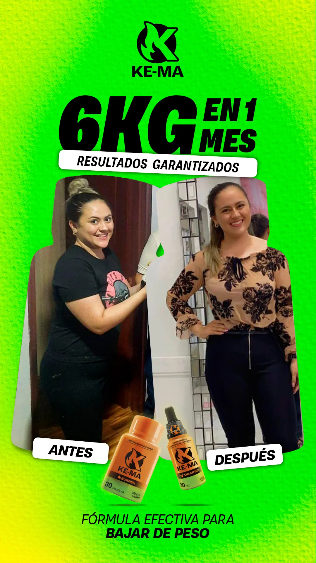 Mujer antes y después usando el Drenador Ke-Ma para bajar de peso. ¡Resultados garantizados!