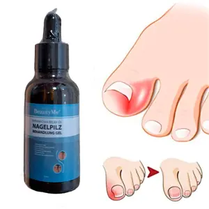 Aceite reparador de uñas "BeautyMe" para aliviar el hongo de uña y la paroniquia en pies.