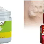 Beevana Crema para alivio del dolor y ungüento para várices con abejas y plantas naturales.