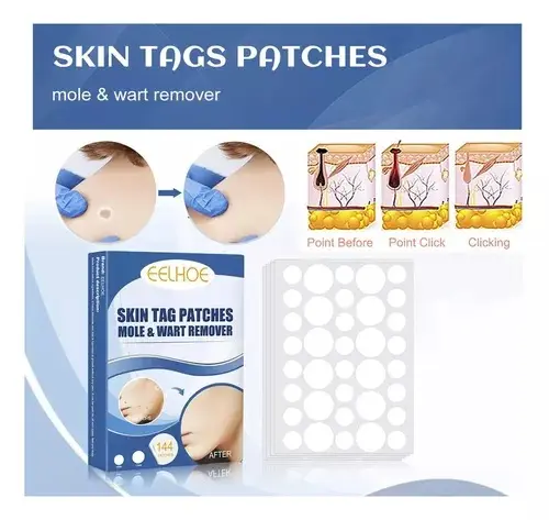 Parche Skin Tag removedor de lunares y verrugas, con antes y después.