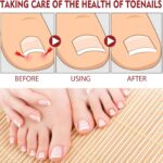 Hongos Toenail Plus – Gotero - Imagen 4