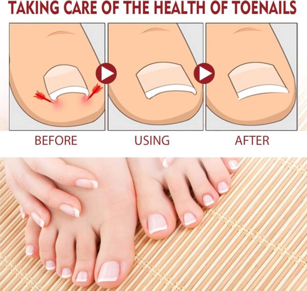 Hongos Toenail Plus – Gotero - Imagen 4