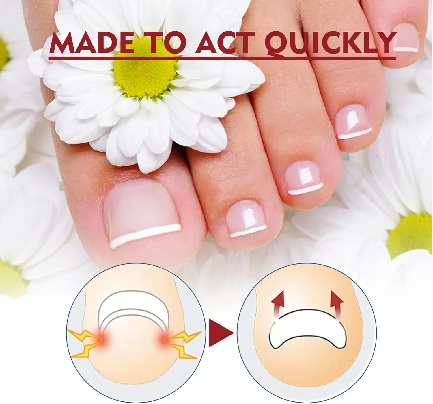 Set x2 Hongos Toenail Plus: uñas saludables, alivio rápido de hongos en los pies.