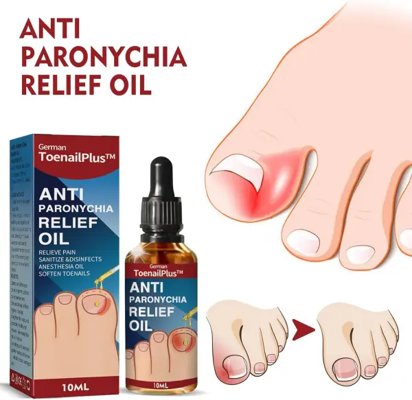 Set x2 Hongos Toenail Plus: alivia paroniquia, desinfecta y suaviza uñas. Gotero.