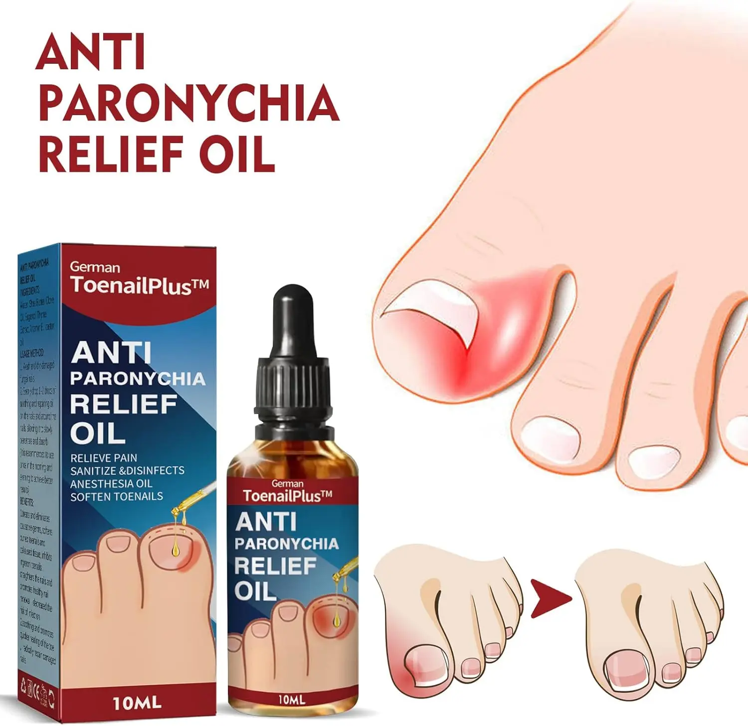 Set x2 Hongos Toenail Plus: alivia paroniquia, desinfecta y suaviza uñas. Gotero.