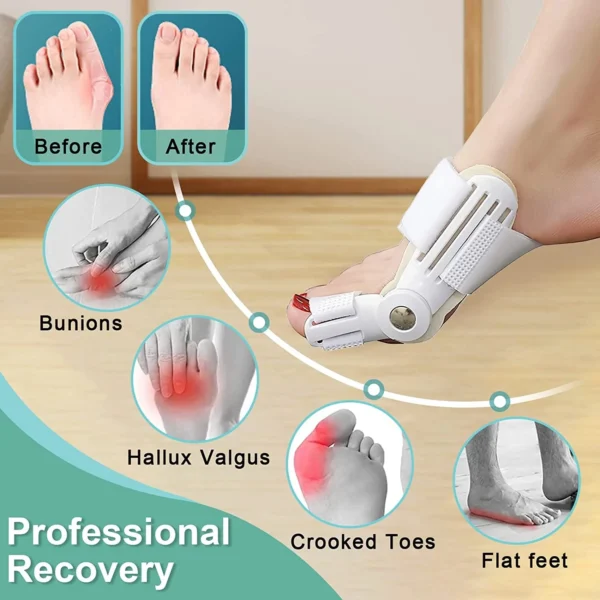 Férula correctora de juanete con soporte para hallux valgus, dedos torcidos y pies planos.
