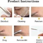 Extractor de espinillas: desinfección, limpieza, punción, arrastre, eliminación de suciedad y preservación.