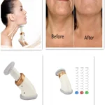 Masajeador reductor de papada: antes y después, con enfoque en cuello y barbilla.