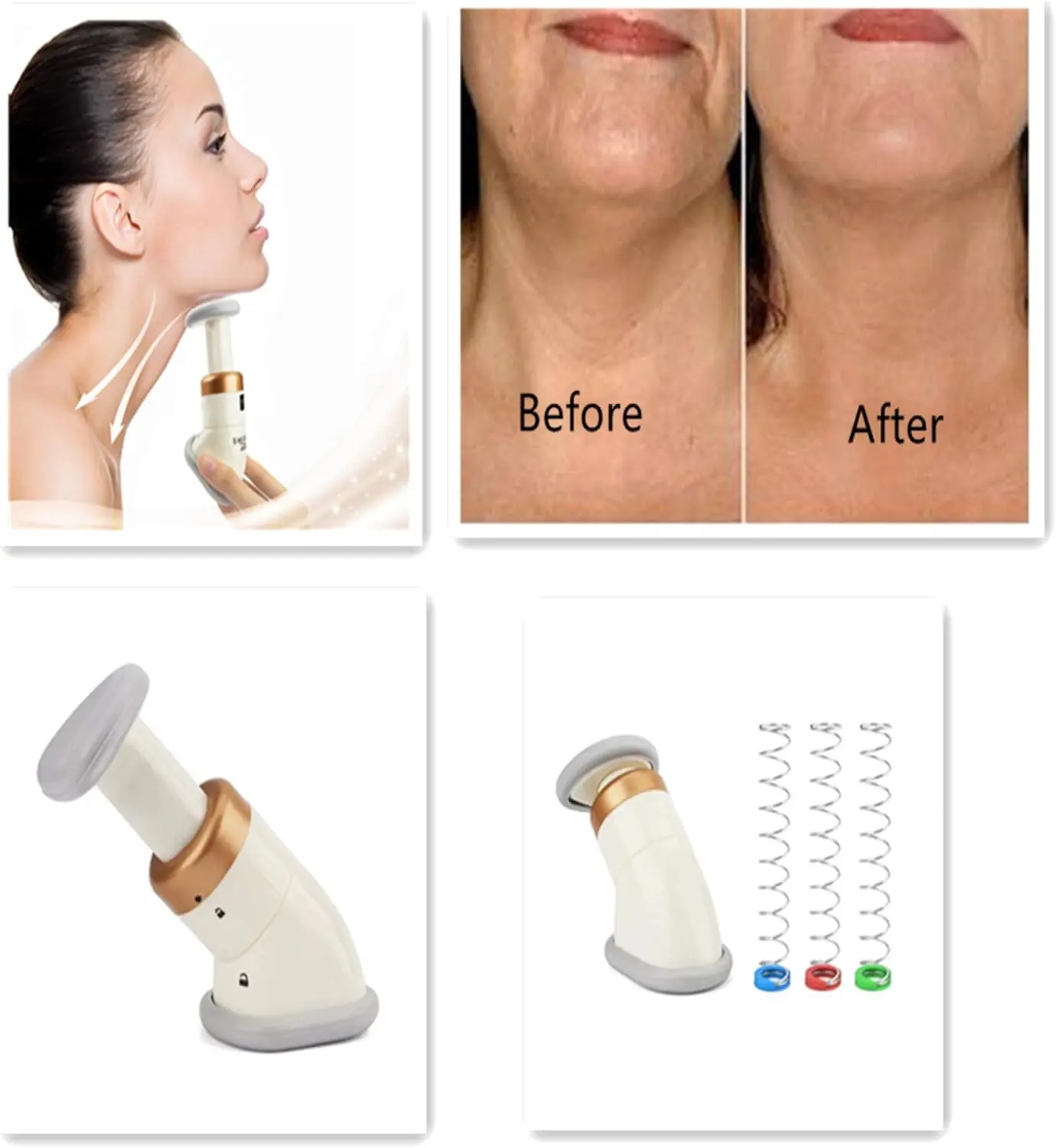 Masajeador reductor de papada: antes y después, con enfoque en cuello y barbilla.