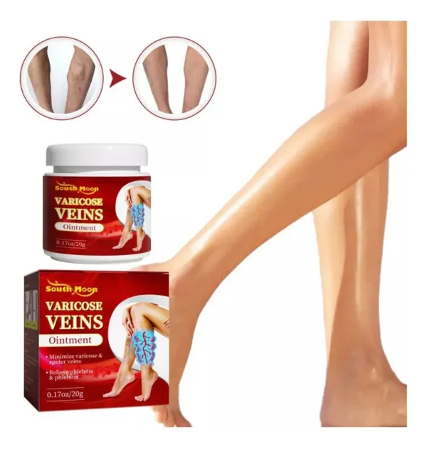 Crema Varicose Veins Beevana: alivia venas varicosas y arañas vasculares en las piernas.