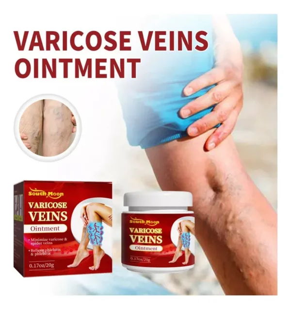 Crema Beevana para várices: alivia y minimiza venas varicosas y arañas vasculares.