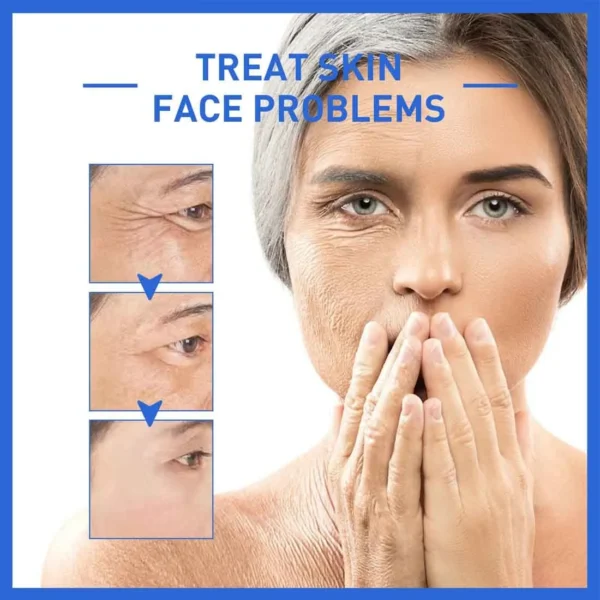 Set x2 Botox Suero Antiarrugas: tratamiento para problemas de piel, reduce líneas de expresión.