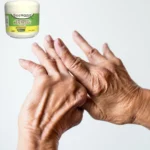 Beevana crema para venas varicosas y alivio del dolor en manos con artritis.