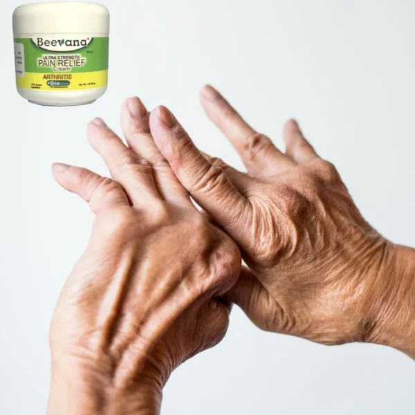 Beevana crema para venas varicosas y alivio del dolor en manos con artritis.