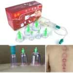 Kit de ventosas de terapia de vacío X6, para terapia de ventosas china.