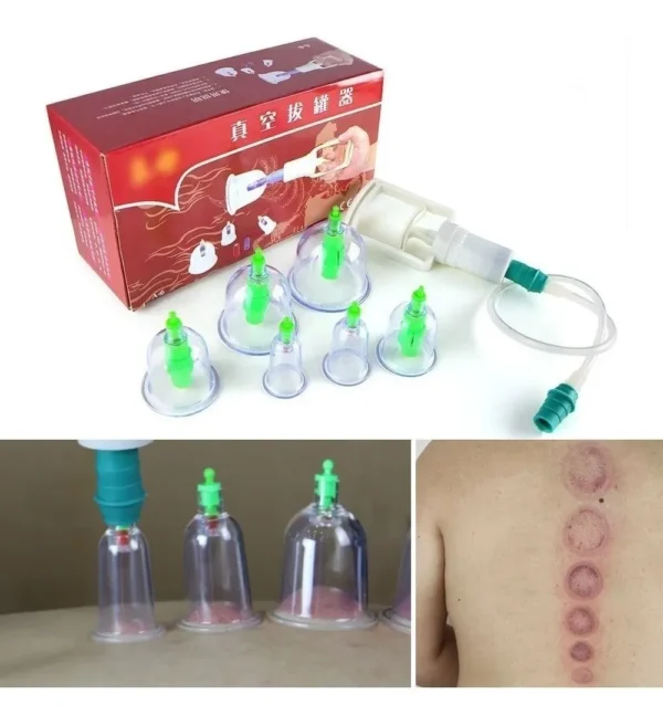 Kit de ventosas de terapia de vacío X6, para terapia de ventosas china.