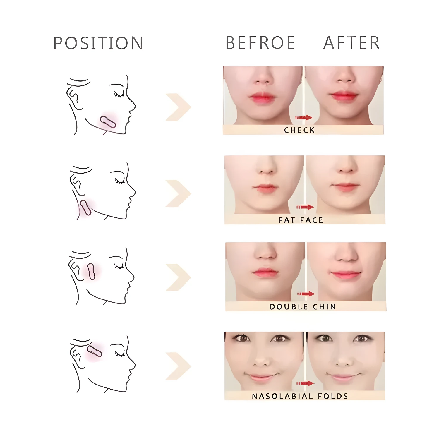 Cinta Facial Secret Lift: antes y después para rostro, papada y pliegues nasolabiales.