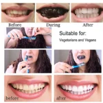 Dientes amarillos a blancos con carbón activado, antes y después.