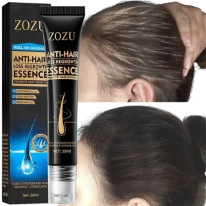 Minoxil aceite crecimiento pelo para mujer con entradas y cabello debilitado, mejora anticaída.