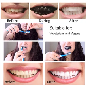 Carbon Activado 60G Blanqueamiento Dental: Antes y después de dientes amarillos a blancos brillantes.
