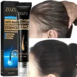 Aceite Minoxil para crecimiento de pelo, roll-on para anticaída y fortalecimiento.
