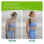 Corrector de postura para soporte de espalda, antes y después.