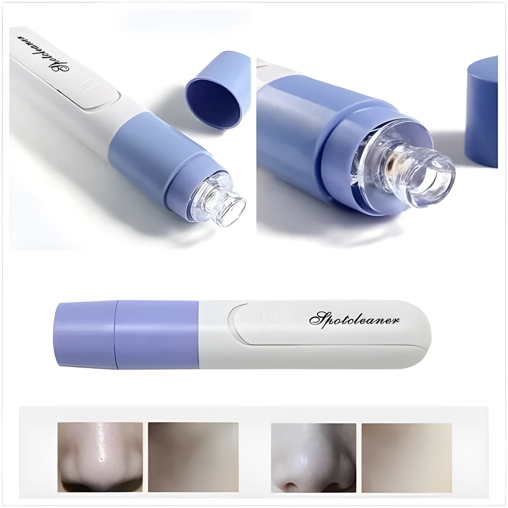 Extractor de espinillas y puntos negros Spotcleaner con punta transparente.