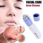 Extractor de espinillas y puntos negros portátil para cuidado facial, limpia poros y acné.
