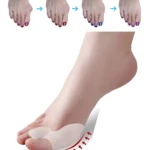 Corrector de juanete de silicona para aliviar el dolor y alinear el dedo gordo del pie.