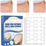 Parches para eliminar verrugas y lunares de piel, antes y después de su uso, caja con 144 unidades.