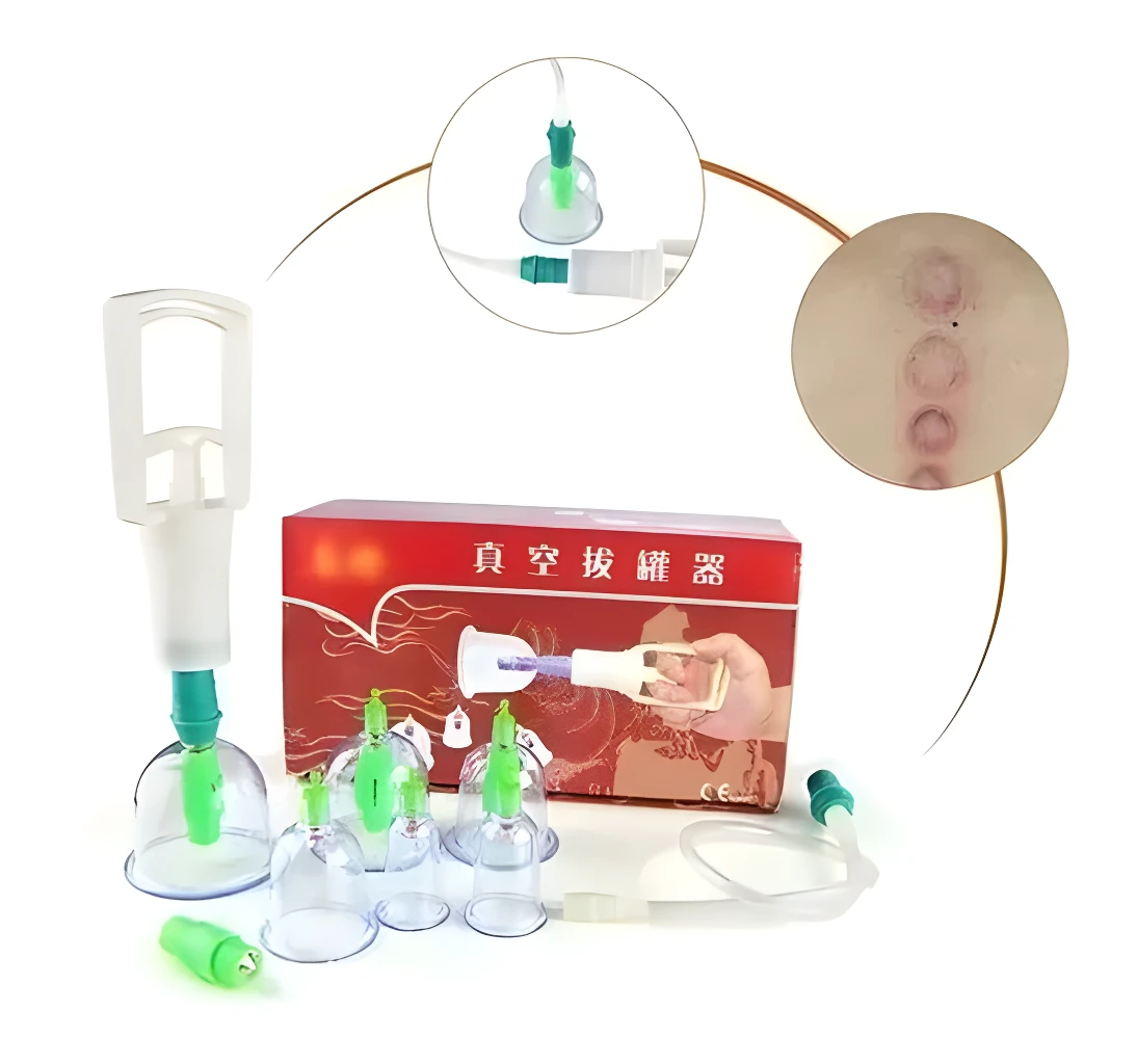 Vacum Terapia X6: set de copas, ventosa y bomba para masaje y relajación corporal.