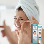 Crema tratamiento acné control gel con AHA & BHA, envase y tubo.