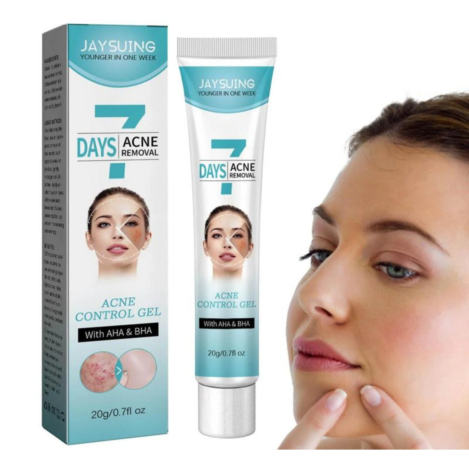 JAYSUING gel control acné 7 días, muestra antes y después en pieles con imperfecciones.