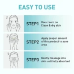 Instrucciones de uso en 3 pasos para crema de tratamiento de acné: limpiar piel seca, aplicar en zona afectada, masajear hasta absorber.