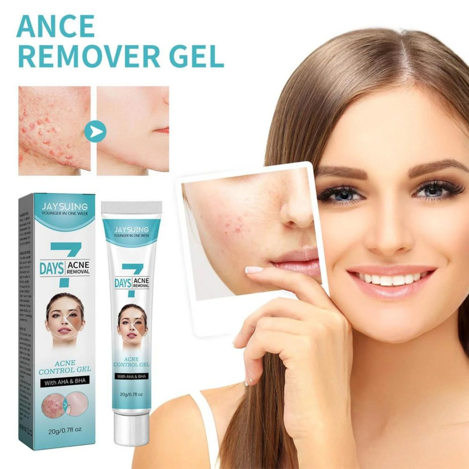 Crema para control de acné JAYSUING, tratamiento facial con AHA & BHA, efecto en 7 días, para piel con imperfecciones.