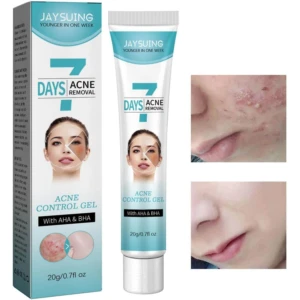JAYSUING 7 Days Acne Control Gel con AHA & BHA, tratamiento facial para eliminar acné en envase de 20g/0.7fl oz.