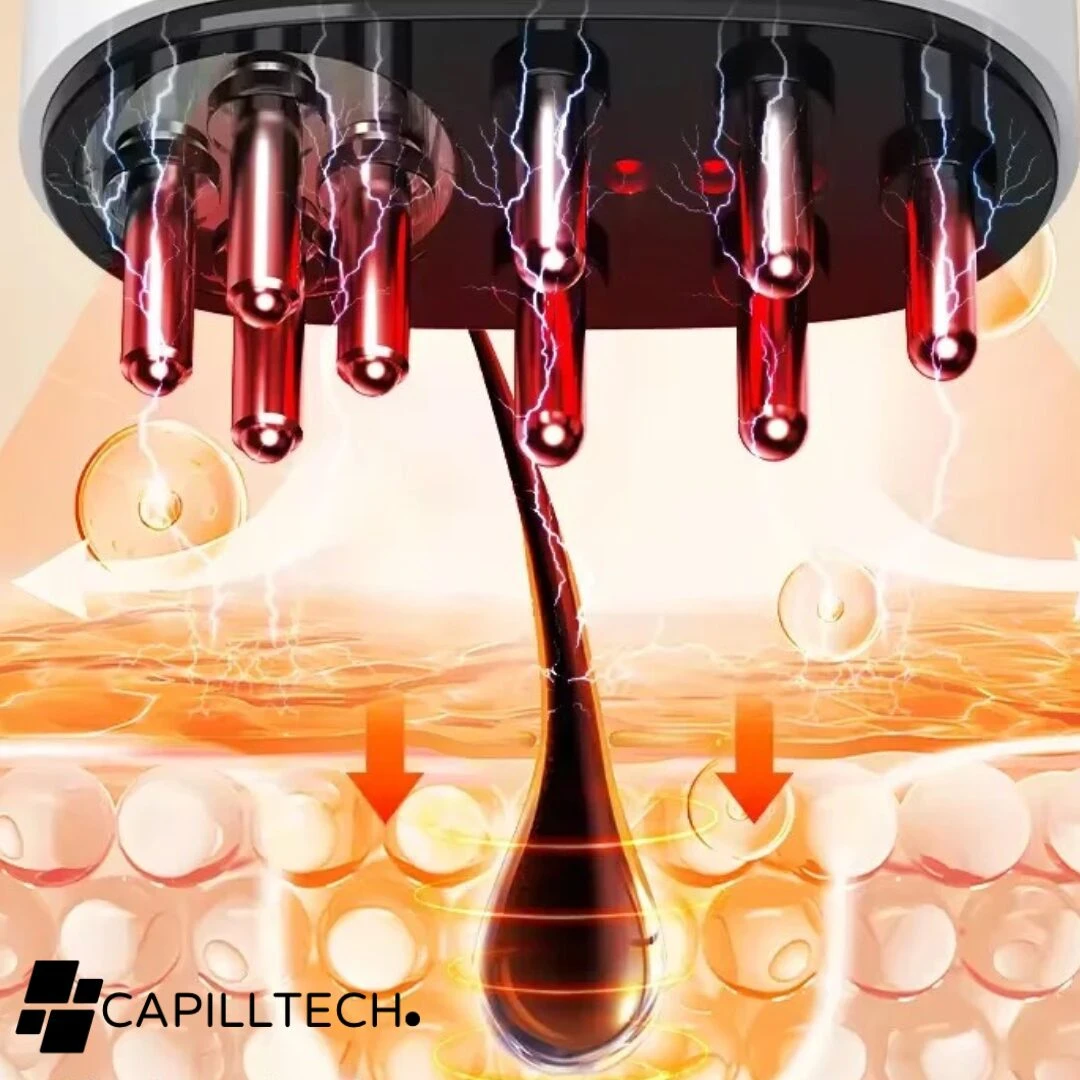 Masajeador capilar portátil con electrodos rojos emitiendo luz, tratando un cabello y cuero cabelludo con micropartículas.