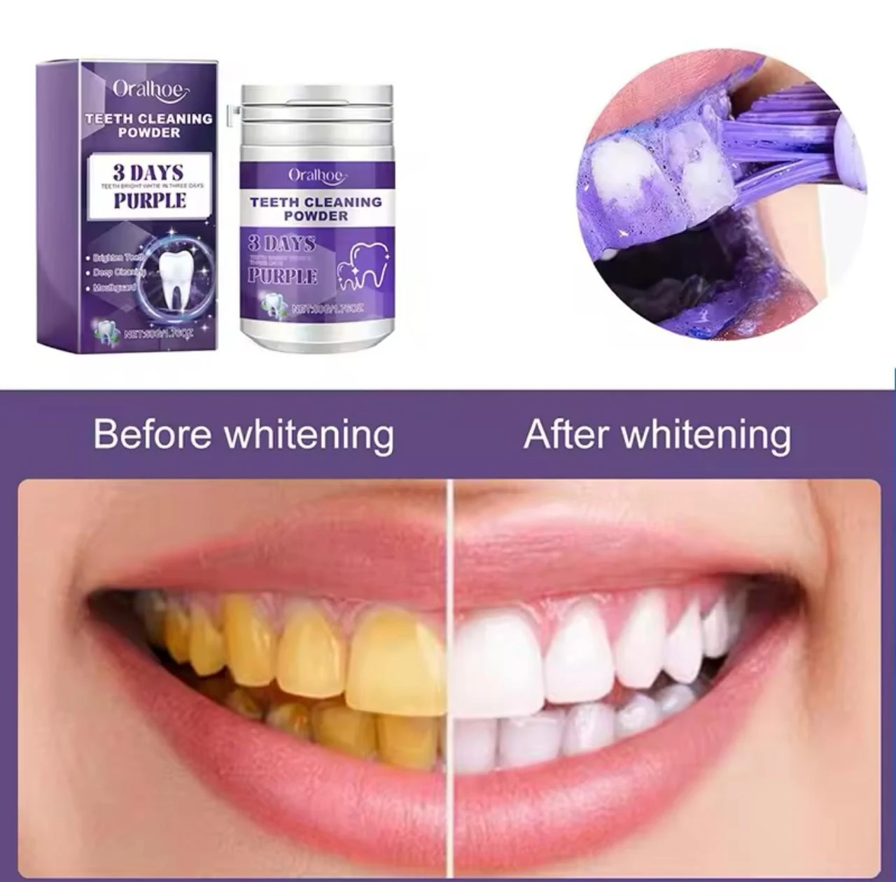 Polvo blanqueador dental morado Oralhoe, limpieza profunda, caja y envase, antes y después de blanquear dientes.