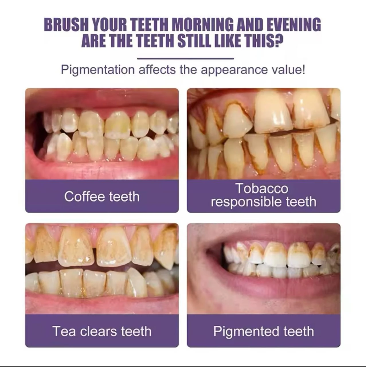 Polvo blanqueador dental morado: compara dientes manchados por café, té, tabaco y pigmentación con antes y después.