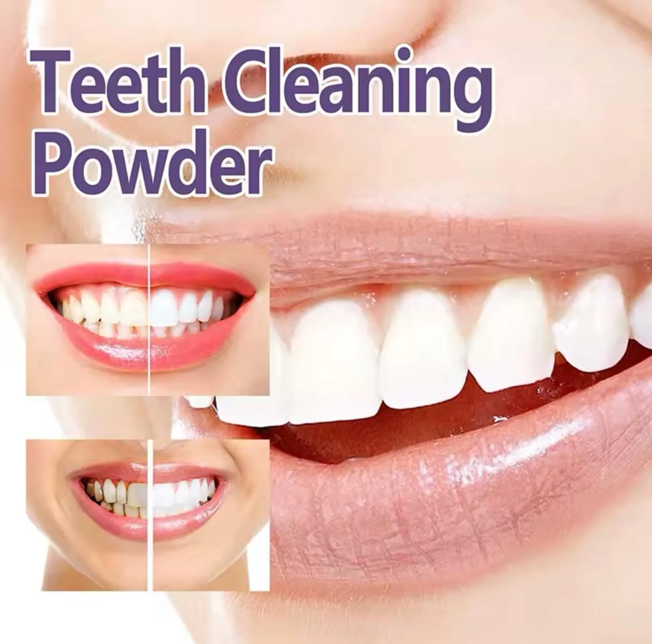 Polvo blanqueador dental morado que muestra antes y después de dientes amarillentos a blancos brillantes.
