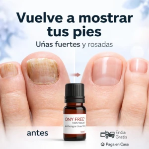Comparativa de uñas de los pies antes y después del uso de aceite antihongos Ony Free 10ml, mostrado en frasco color ámbar con tapa negra.