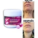 Crema anti-edad Zamia con extracto de cebolla roja, antes y después, para reducir arrugas.