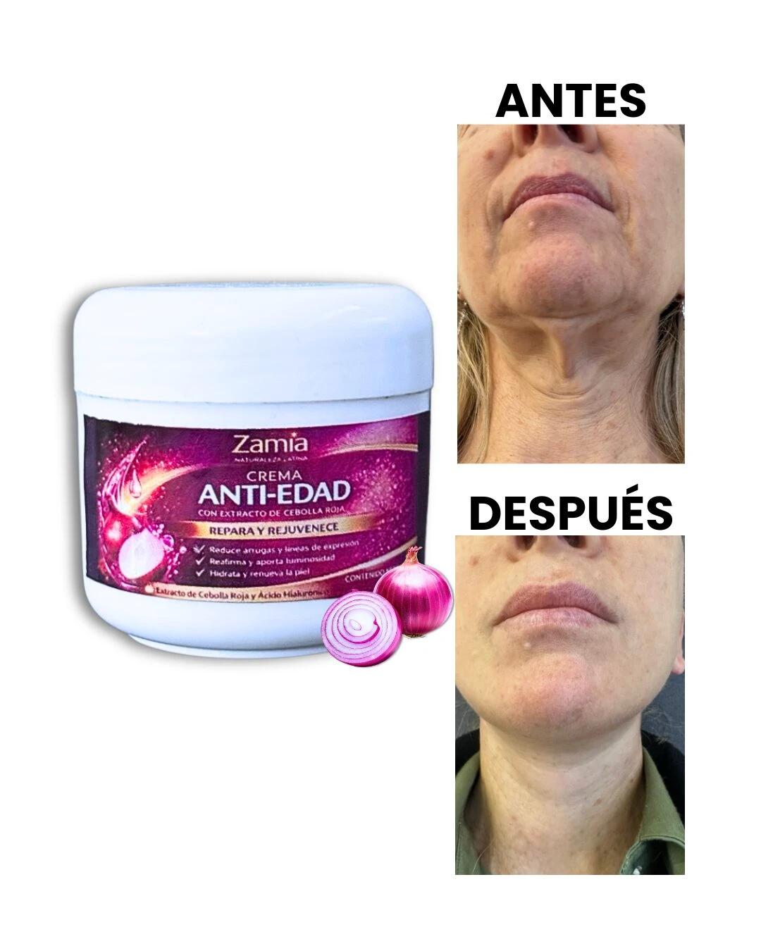 Crema anti-edad Zamia con extracto de cebolla roja, antes y después, para reducir arrugas.