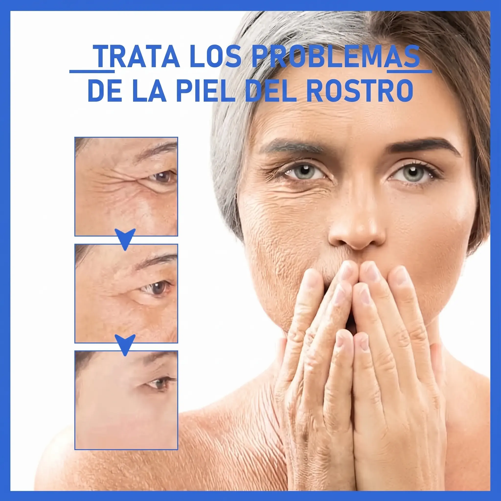 Tratamiento facial antiarrugas para reducir líneas de expresión en el rostro, con antes y después visible alrededor de los ojos.