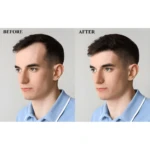 Comparativa antes y después de hombre con Elixir Crecimiento Capilar Fortalecedor, mostrando aumento de densidad capilar.